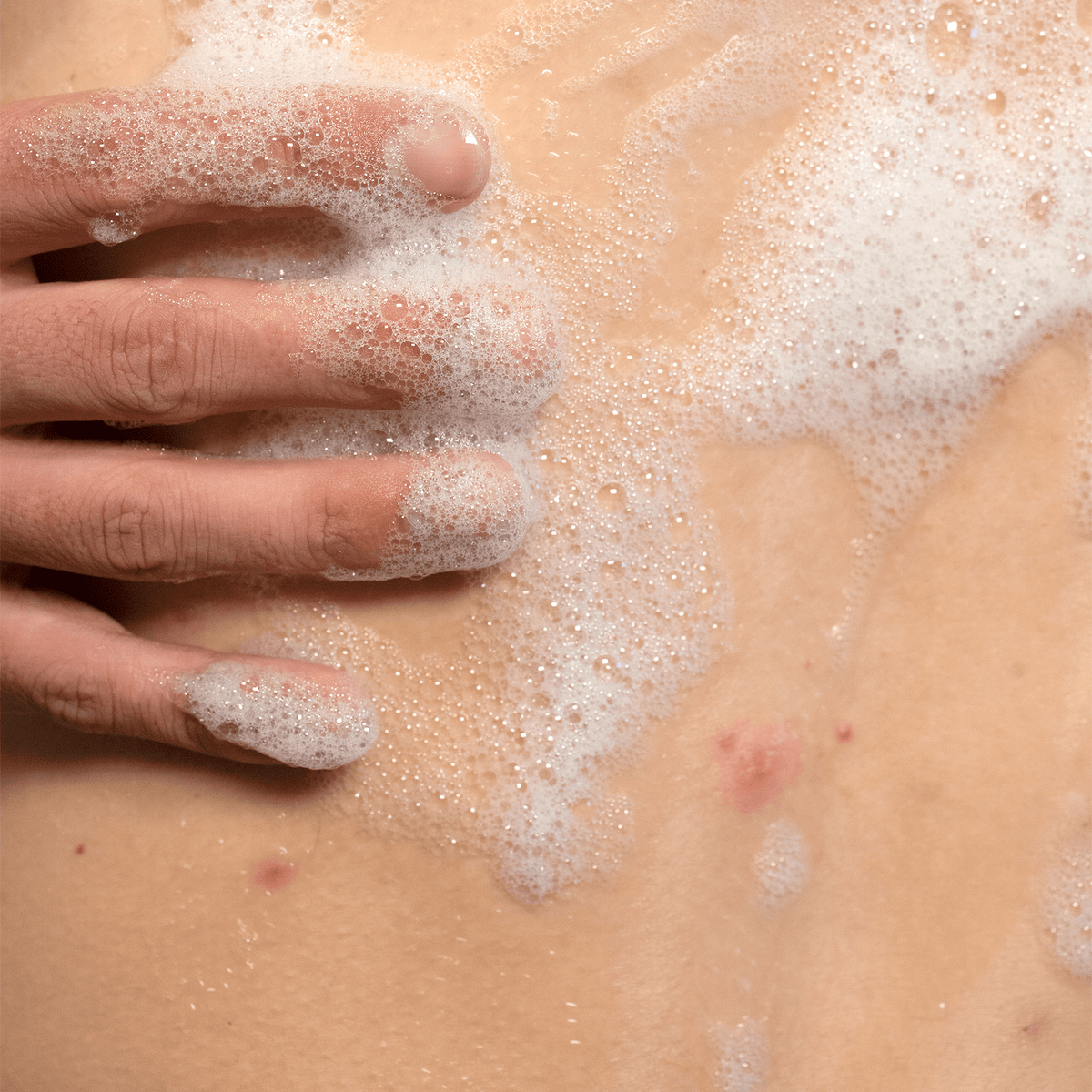Clear Start Back Treatment