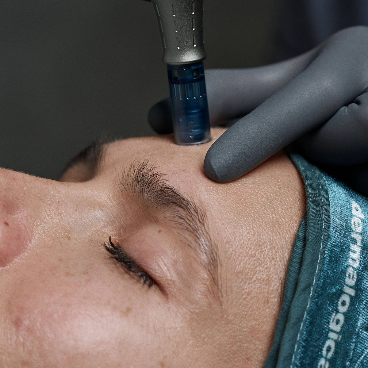 Pro Microneedling